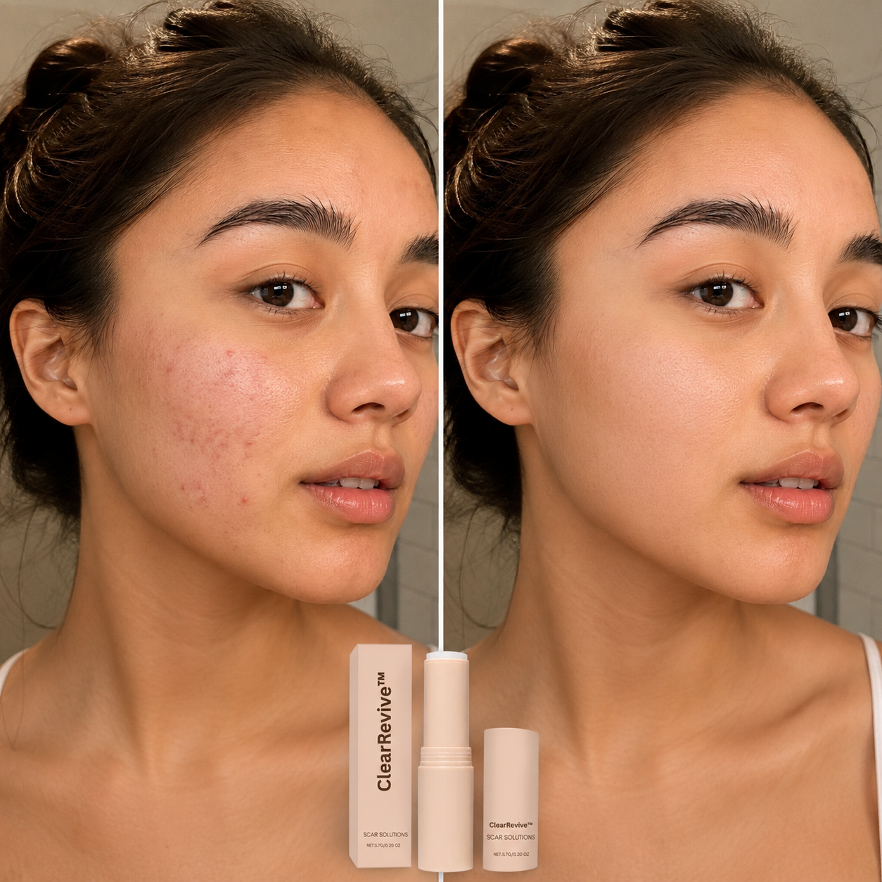 ClearRevive™ - Acne Scar Care Stick ✨